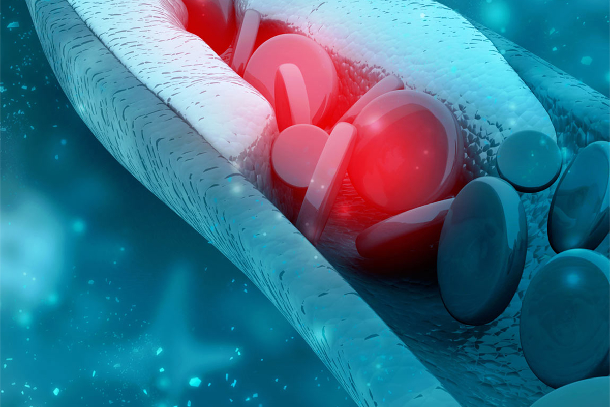 Titelbild zu „Welche Nahrungsergänzungsmittel zur Senkung des Cholesterinspiegels?“
